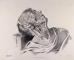Neck Prints: Historical Anatomical Illustration