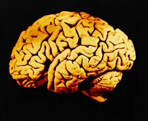 Cortex Prints: Human Brain