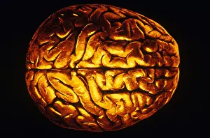 Surface Prints: Human Brain
