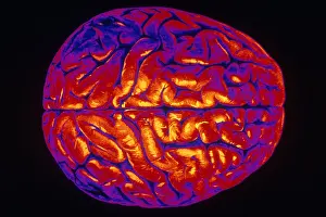 Surface Prints: Human Brain