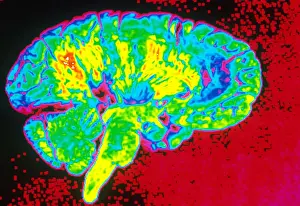 Cerebrum Prints: Human Brain