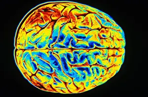 Surface Prints: Human Brain