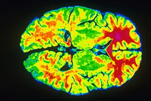 Magnetic Prints: Human Brain
