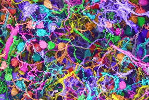 Human Brain Cells, under a microscope (SEM)