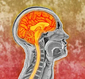 Concept Prints: Human Brain, Colorized Illustration