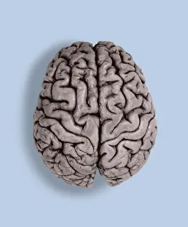 Part Prints: Human Brain, gross specimen