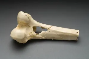 Details Prints: Human Distal Femur, Gunshot Wound, 1984