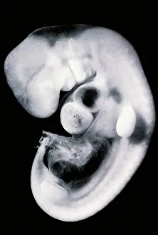 2000 Prints: Human embryo