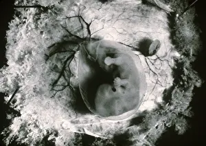 Fetal Prints: Human Embryo