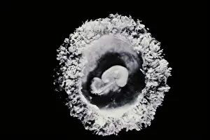 2000 Prints: Human embryo