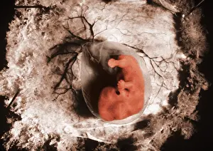 Fetal Prints: Human Embryo, gross specimen