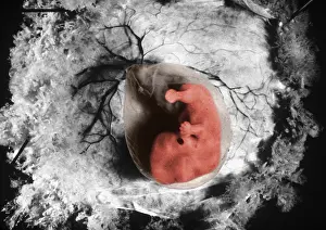 Fetal Prints: Human Embryo, gross specimen