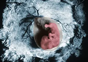 Fetal Prints: Human Embryo, gross specimen
