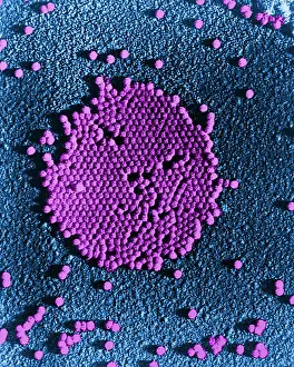Enterovirus Prints: Human Enterovirus, Poliovirus, TEM