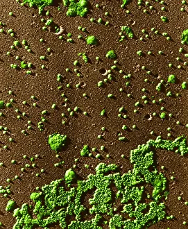 Enterovirus Prints: Human Enterovirus, Poliovirus, TEM