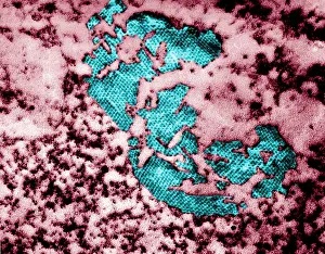 Enterovirus Prints: Human Enterovirus, Poliovirus, TEM