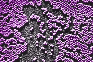 Enterovirus Prints: Human Enterovirus, Poliovirus, TEM