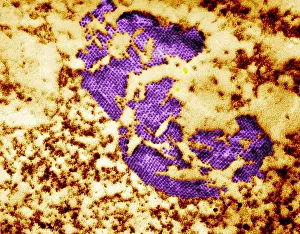 Pathogen Prints: Human Enterovirus, Poliovirus, TEM