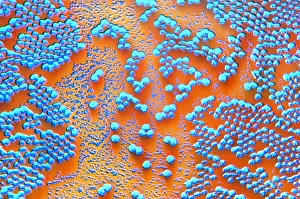 Pathogen Prints: Human Enterovirus, Poliovirus, TEM
