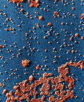 Human Enterovirus, Poliovirus, TEM