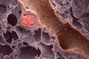 Blood Prints: Human Lung, under a microscope (SEM)