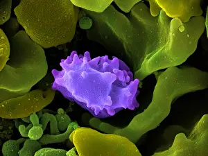 System Prints: Human Lymphocyte Cell, under a microscope (SEM)