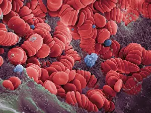 Human Red Blood Cells, under a microscope (SEM)