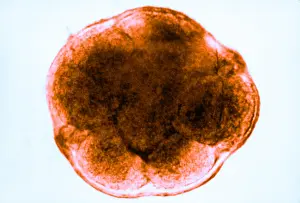 Mammalian Prints: Human Reproduction, Ovum, 8-Cell Stage, light micrograph