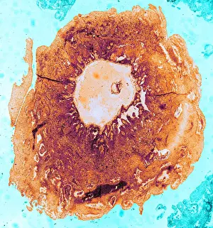 Mammalian Prints: Human Reproduction, Ovum, TEM