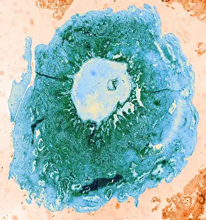 Mammalian Prints: Human Reproduction, Ovum, TEM