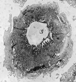 Reproductive Prints: Human Reproduction, Ovum, TEM
