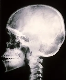Cord Prints: Human Skull