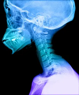 Medical Prints: Human Skull and Cervical Spine