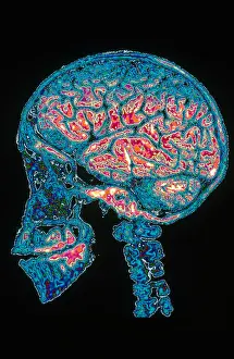Profile Prints: Human Skull X-Ray with Digitized Brain