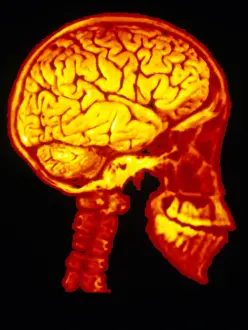 Profile Prints: Human Skull X-Ray with Digitized Brain
