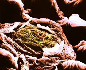 Papilla Prints: Human tongue papilla, under a microscope (SEM)
