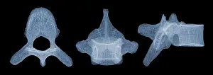 Body Prints: Human Vertebra T5, X-ray