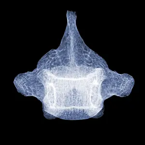 Body Prints: Human Vertebra T5, X-ray