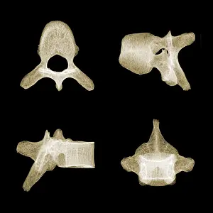 Body Prints: Human Vertebra T5, X-ray