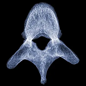 Body Prints: Human Vertebra T5, X-ray