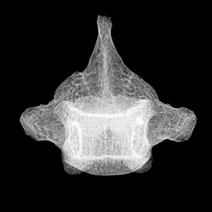 Body Prints: Human Vertebra T5, X-ray