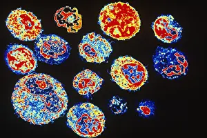 Electron Prints: Human White Blood Cells