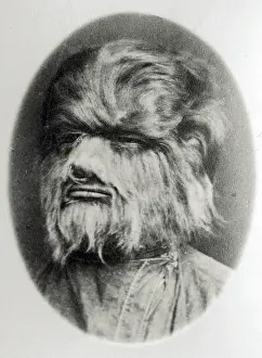 Weird Prints: Hypertrichosis, 19th Century