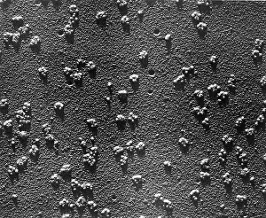 Rabbit Prints: Immature RBCs, Reticulocyte Polyribosomes, TEM