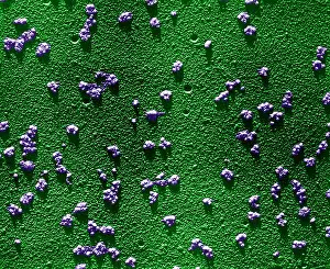 Rabbit Prints: Immature RBCs, Reticulocyte Polyribosomes, TEM