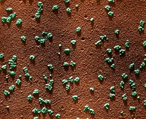 Rabbit Prints: Immature RBCs, Reticulocyte Polyribosomes, TEM
