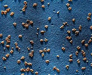Rabbit Prints: Immature RBCs, Reticulocyte Polyribosomes, TEM