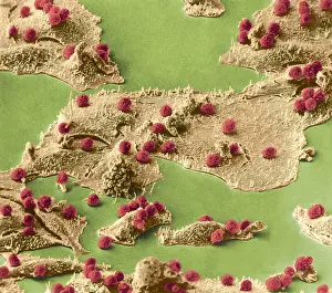 Leukocytes Prints: Immune Cells Attacking Cancer Cells, under a microscope (SEM)