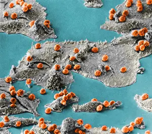 Leukocytes Prints: Immune Cells Attacking Cancer Cells, under a microscope (SEM)