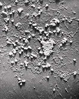 Particles Prints: Influenza B